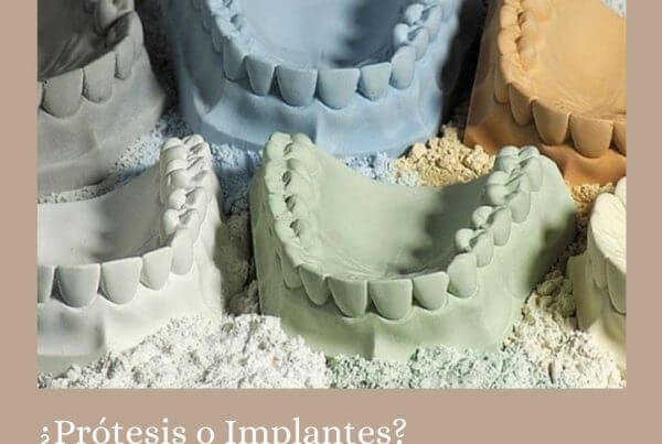 ¿Prótesis o implantes?
