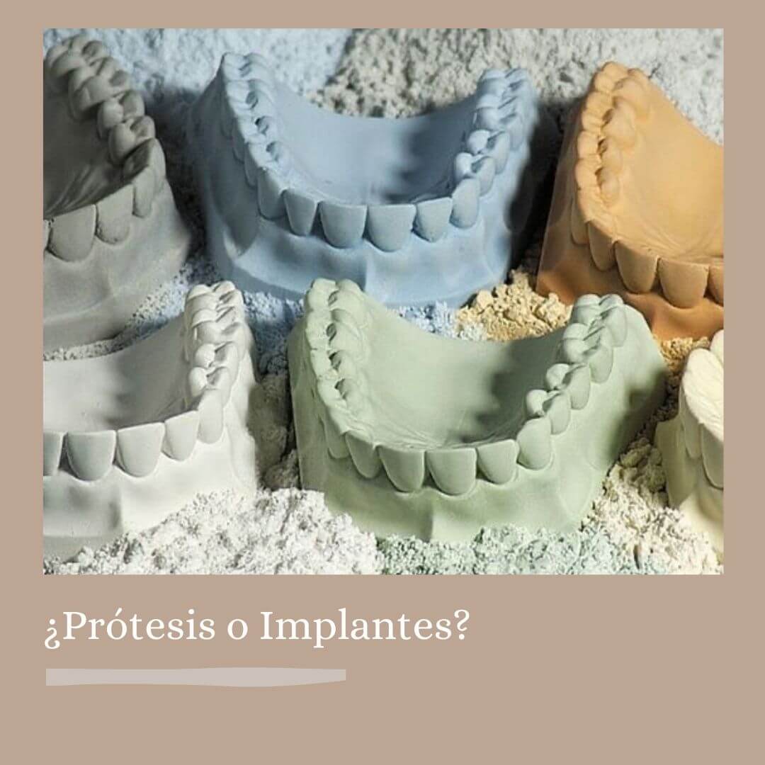 ¿Prótesis o implantes?