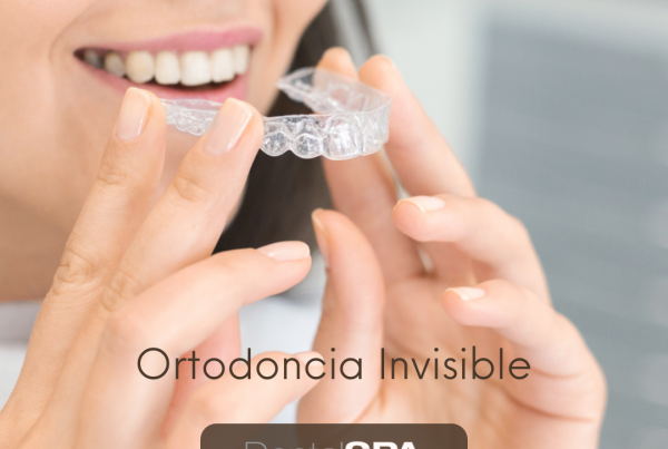 Descubre la sonrisa de tus sueños con ortodoncia invisible